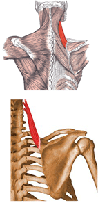 diagram showing the levator scapulae muscle, which stretches like a cable from the shoulder blade straight up to the top of the neck