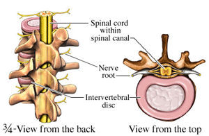 best way to sleep for pinched nerve in neck