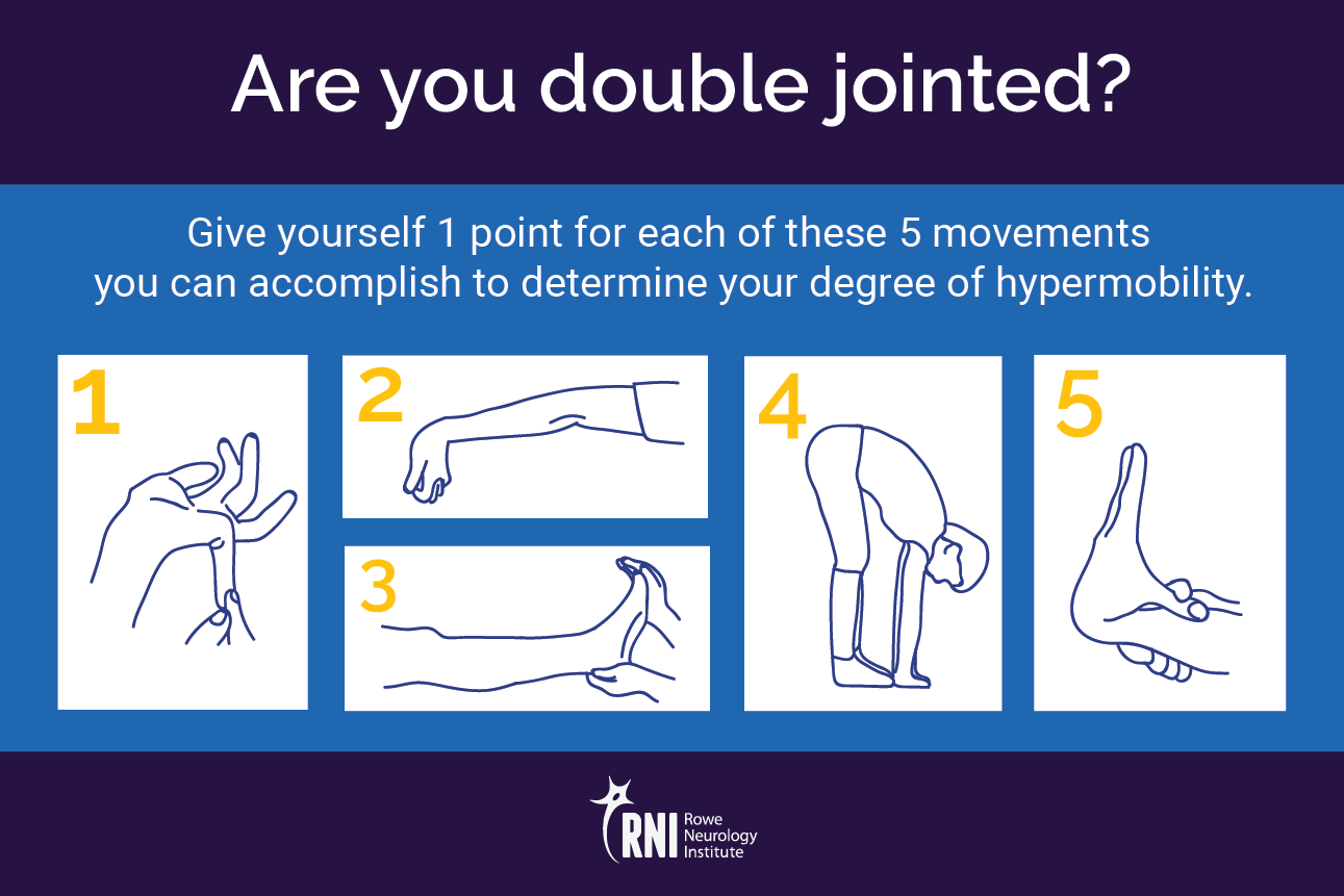 All About Hypermobility - Supporting Your Loose Joints - Simple Wellness  Myotherapy & Remedial Massage