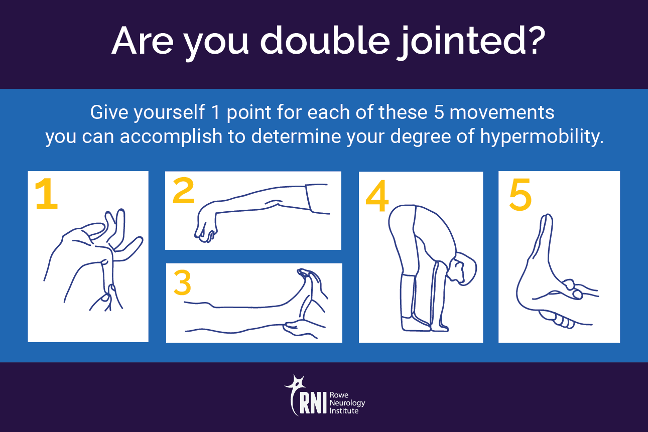 Are You Hyperflexible The Neurology Of Hypermobility Rowe Neurology Institute